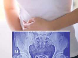 man-complained-of-stomach-pain