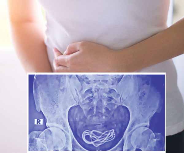 man-complained-of-stomach-pain